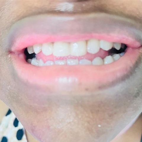 A healthy, happy smile after treatment at MV Nzama Dental
